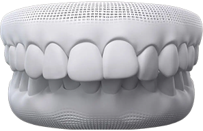 over-bite