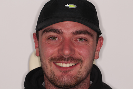 After Invisalign Treatment Reading Smiles