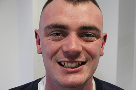 Before Invisalign Treatment Reading Smiles