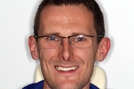 After Invisalign Treatment Reading Smiles