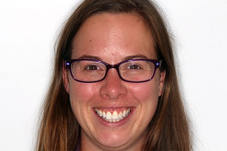 After Invisalign Treatment Reading Smiles