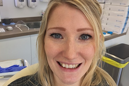 Before Invisalign Treatment Reading Smiles